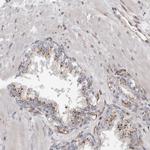 PEX6 Antibody in Immunohistochemistry (IHC)