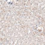 NMU Antibody in Immunohistochemistry (Paraffin) (IHC (P))