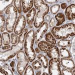 RAB18 Antibody in Immunohistochemistry (Paraffin) (IHC (P))