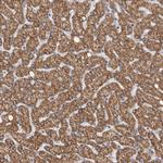 RAB18 Antibody in Immunohistochemistry (Paraffin) (IHC (P))