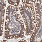 RAB18 Antibody in Immunohistochemistry (Paraffin) (IHC (P))