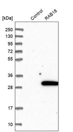 RAB18 Antibody in Western Blot (WB)