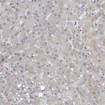 UTP6 Antibody in Immunohistochemistry (IHC)