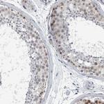 UTP6 Antibody in Immunohistochemistry (IHC)