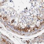 Plectin Antibody in Immunohistochemistry (IHC)