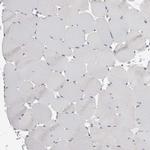 GATM Antibody in Immunohistochemistry (IHC)