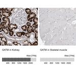 GATM Antibody