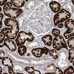 GATM Antibody in Immunohistochemistry (IHC)