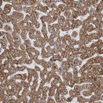 GATM Antibody in Immunohistochemistry (IHC)