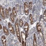 GATM Antibody in Immunohistochemistry (IHC)