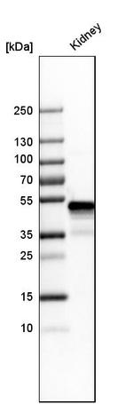 GATM Antibody in Western Blot (WB)