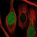 CDCA2 Antibody in Immunocytochemistry (ICC/IF)