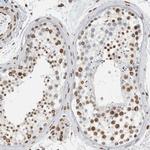 CDCA2 Antibody in Immunohistochemistry (IHC)