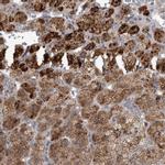 RAB29 Antibody in Immunohistochemistry (IHC)