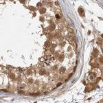 CAMSAP2 Antibody in Immunohistochemistry (IHC)