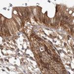 CAMSAP2 Antibody in Immunohistochemistry (IHC)