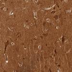 CAMSAP2 Antibody in Immunohistochemistry (IHC)