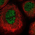 PSMB2 Antibody in Immunocytochemistry (ICC/IF)