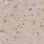 PSMB2 Antibody in Immunohistochemistry (Paraffin) (IHC (P))