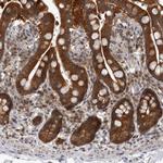 PSMB2 Antibody in Immunohistochemistry (Paraffin) (IHC (P))