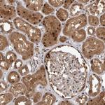 PSMB2 Antibody in Immunohistochemistry (Paraffin) (IHC (P))