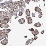 PSMB2 Antibody in Immunohistochemistry (Paraffin) (IHC (P))