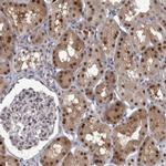 PSMB2 Antibody in Immunohistochemistry (IHC)