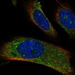 RAB14 Antibody in Immunocytochemistry (ICC/IF)