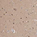 RAB14 Antibody in Immunohistochemistry (Paraffin) (IHC (P))