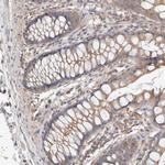 RAB14 Antibody in Immunohistochemistry (Paraffin) (IHC (P))