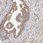 RAB14 Antibody in Immunohistochemistry (Paraffin) (IHC (P))