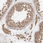 RAB14 Antibody in Immunohistochemistry (IHC)