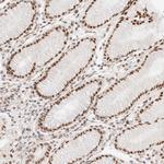 ZC3H11A Antibody in Immunohistochemistry (Paraffin) (IHC (P))