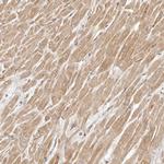 ARHGEF10L Antibody in Immunohistochemistry (Paraffin) (IHC (P))