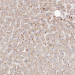 ARHGEF10L Antibody in Immunohistochemistry (Paraffin) (IHC (P))