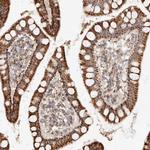 ARHGEF10L Antibody in Immunohistochemistry (Paraffin) (IHC (P))