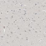 MRTO4 Antibody in Immunohistochemistry (Paraffin) (IHC (P))