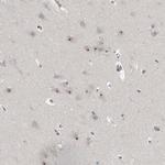 MRTO4 Antibody in Immunohistochemistry (Paraffin) (IHC (P))