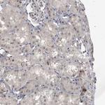 MRTO4 Antibody in Immunohistochemistry (Paraffin) (IHC (P))