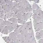 MRTO4 Antibody in Immunohistochemistry (Paraffin) (IHC (P))