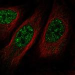 BIKE Antibody in Immunocytochemistry (ICC/IF)