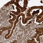 BIKE Antibody in Immunohistochemistry (Paraffin) (IHC (P))