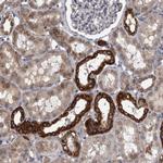 DBT Antibody in Immunohistochemistry (Paraffin) (IHC (P))