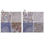 DBT Antibody in Immunohistochemistry (IHC)