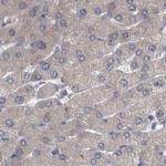 DBT Antibody in Immunohistochemistry (IHC)