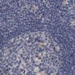 DBT Antibody in Immunohistochemistry (IHC)