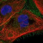 C1QBP Antibody in Immunocytochemistry (ICC/IF)