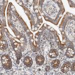 C1QBP Antibody in Immunohistochemistry (Paraffin) (IHC (P))