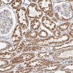 C1QBP Antibody in Immunohistochemistry (Paraffin) (IHC (P))