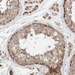 C1QBP Antibody in Immunohistochemistry (Paraffin) (IHC (P))